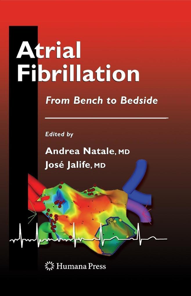 Produktbild: Atrial Fibrillation