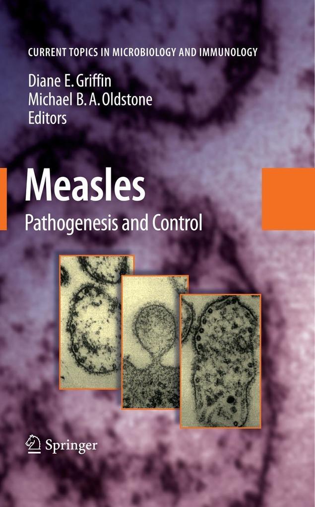 Produktbild: Measles