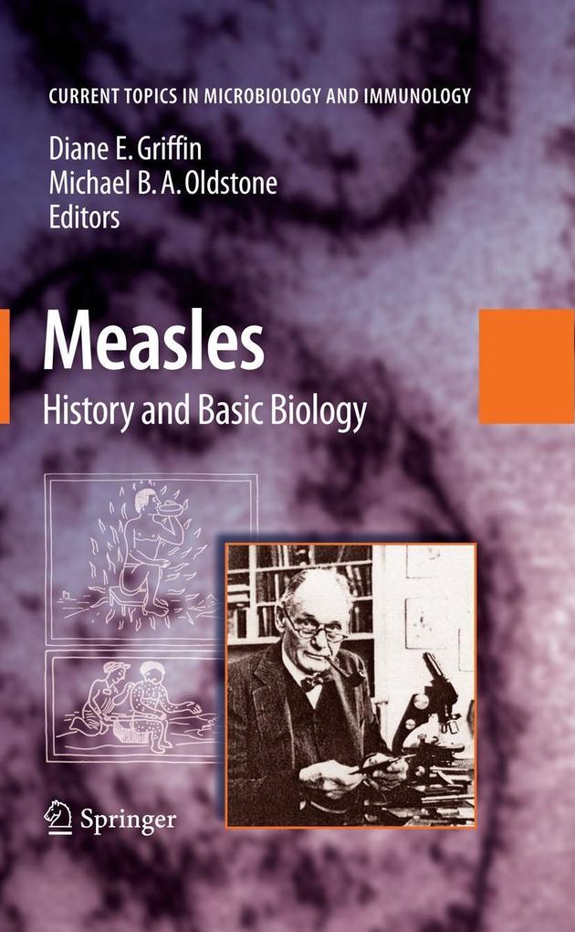 Produktbild: Measles