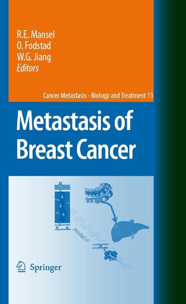 Produktbild: Metastasis of Breast Cancer