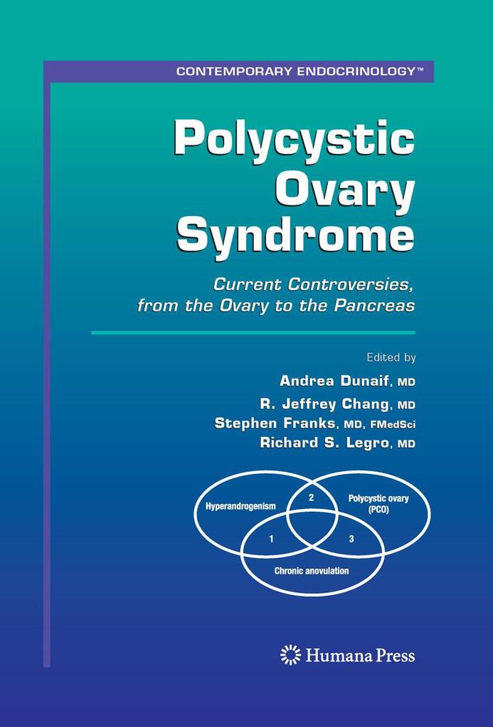 Produktbild: Polycystic Ovary Syndrome