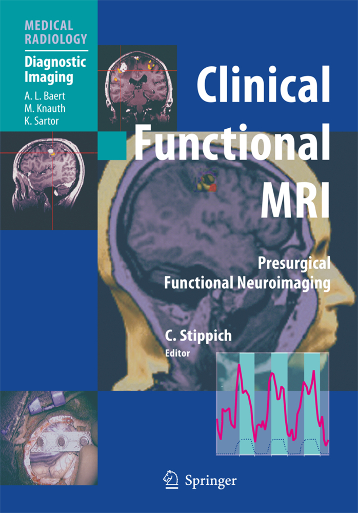 Produktbild: Clinical Functional MRI | K. Sartor