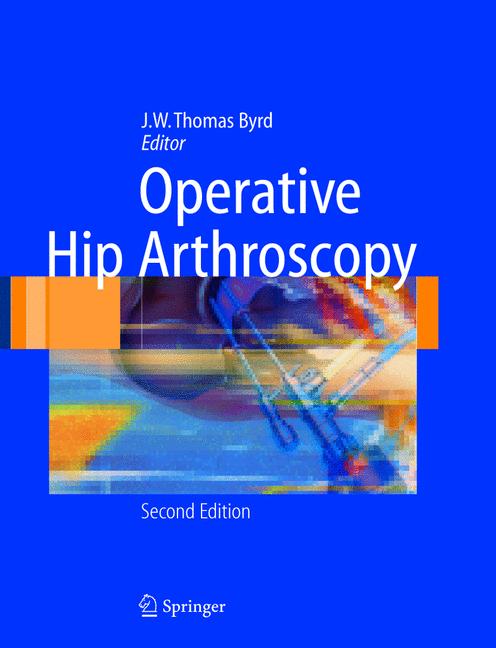 Weitere Ansicht: Operative Hip Arthroscopy