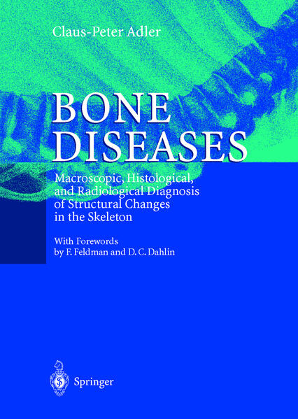 Produktbild: Bone Diseases | Claus-Peter Adler