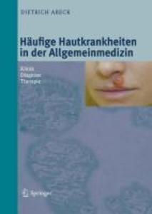 Produktbild: Häufige Hautkrankheiten in der Allgemeinmedizin | Dietrich Abeck