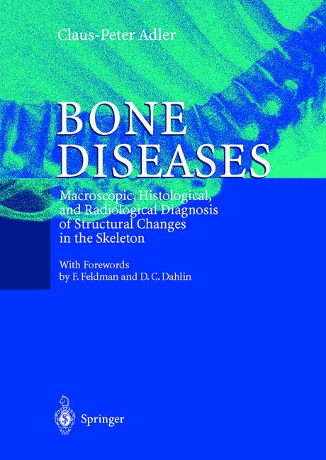Weitere Ansicht: Bone Diseases | Claus-Peter Adler