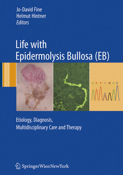 Produktbild: Life with Epidermolysis Bullosa (EB) | Christopher Lanschützer, Martin Laimer, Gabriela Pohla-Gubo, Elke Nischler, Robin A. Eady