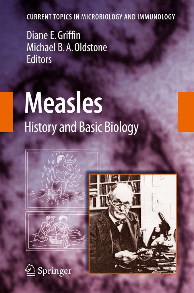 Produktbild: Measles