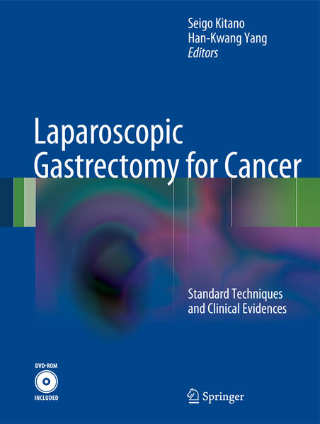 Produktbild: Laparoscopic Gastrectomy for Cancer