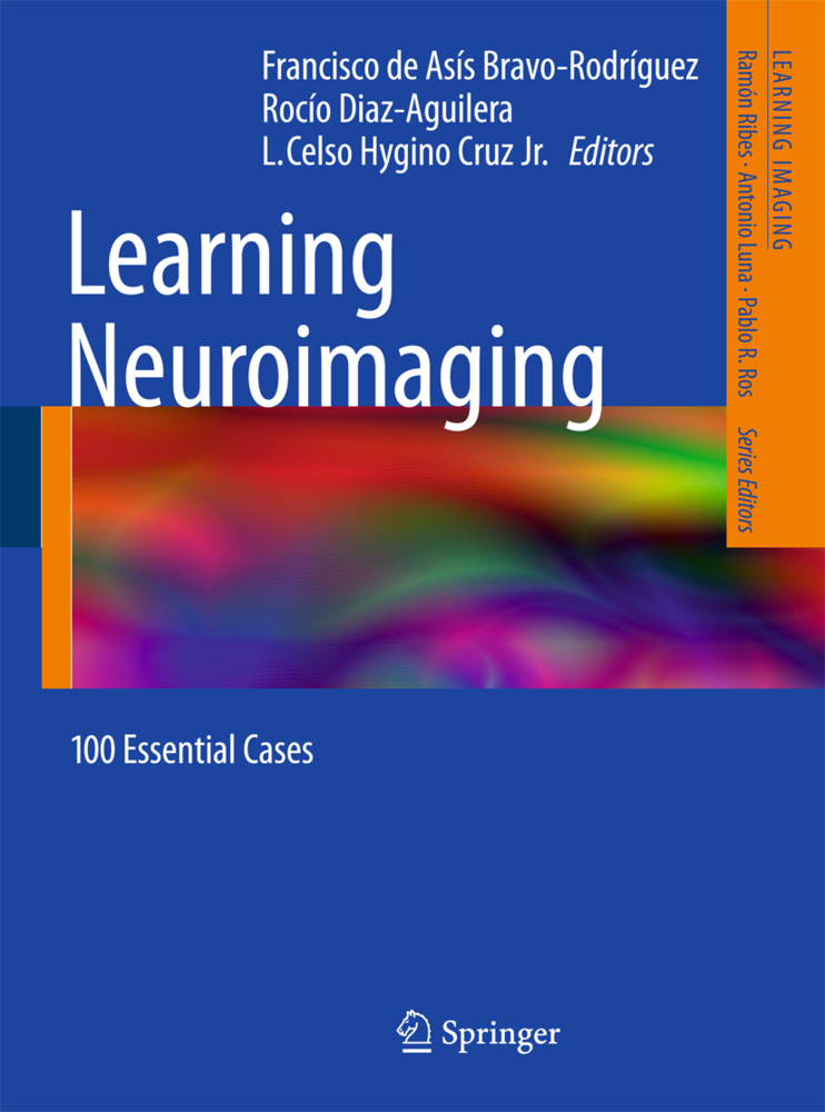 Produktbild: Learning Neuroimaging