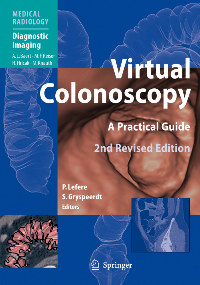 Produktbild: Virtual Colonoscopy | Albert L. Baert