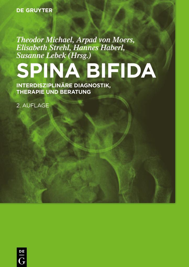 Produktbild: Spina bifida
