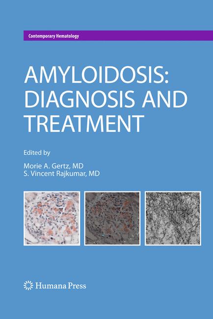 Weitere Ansicht: Amyloidosis