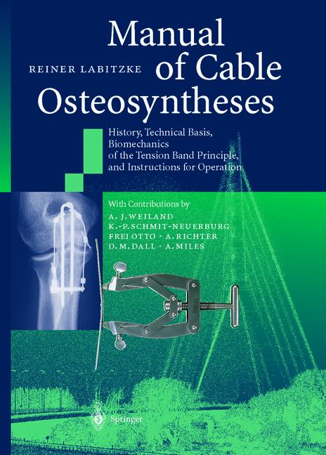 Weitere Ansicht: Manual of Cable Osteosyntheses | Reiner Labitzke