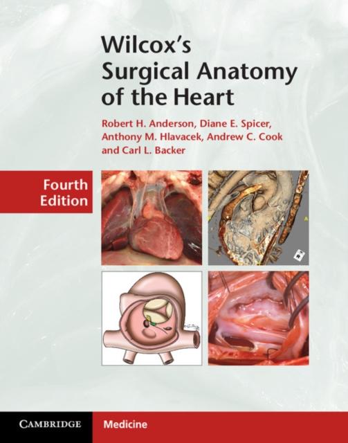 Wilcoxs Surgical Anatomy of the Heart.pdf