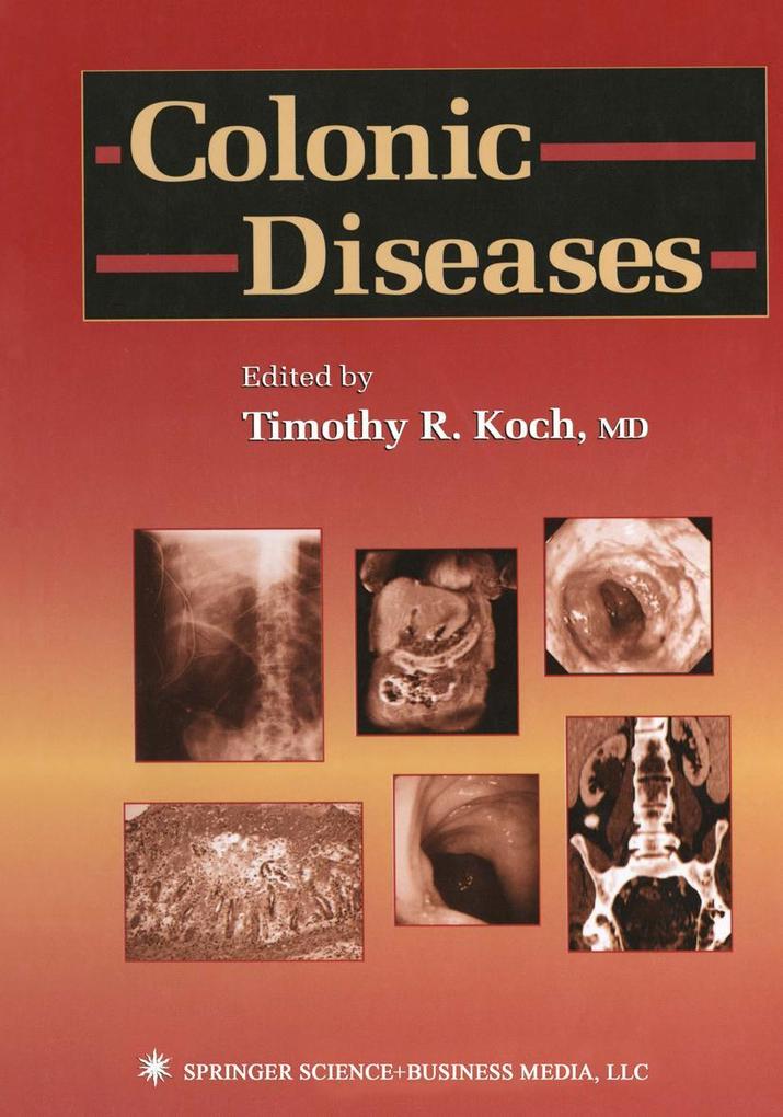 Colonic Diseases.pdf