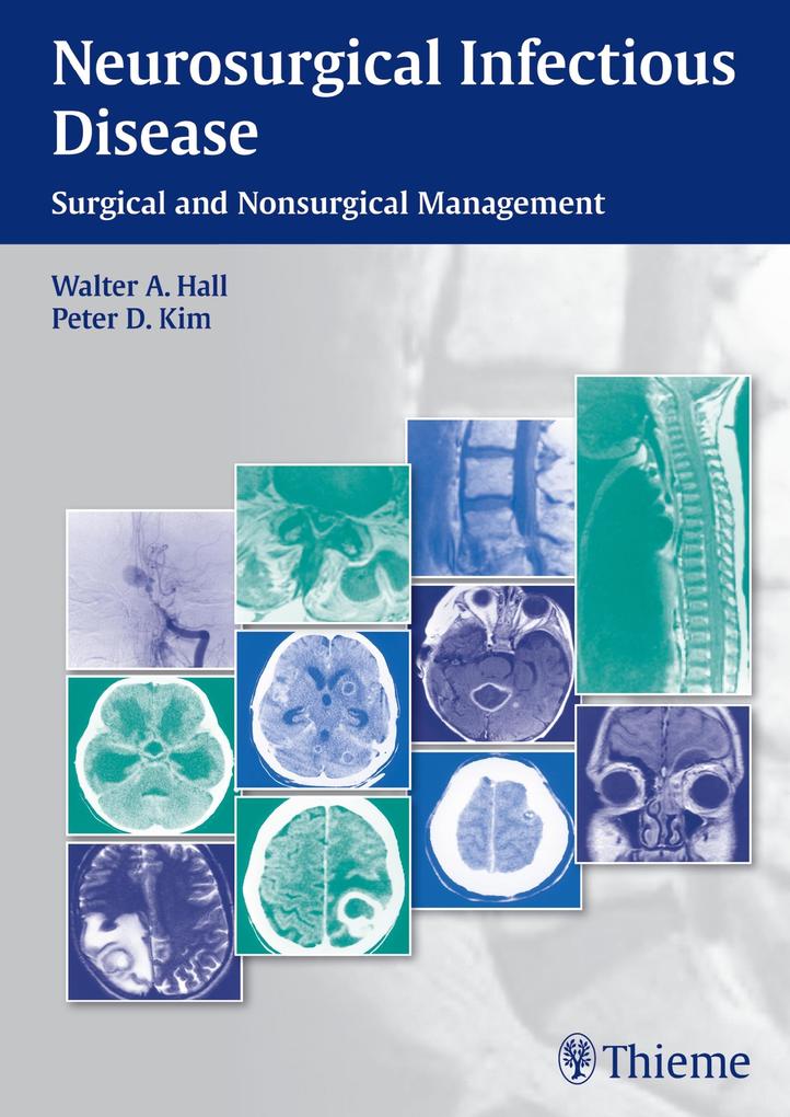Produktbild: Neurosurgical Infectious Disease