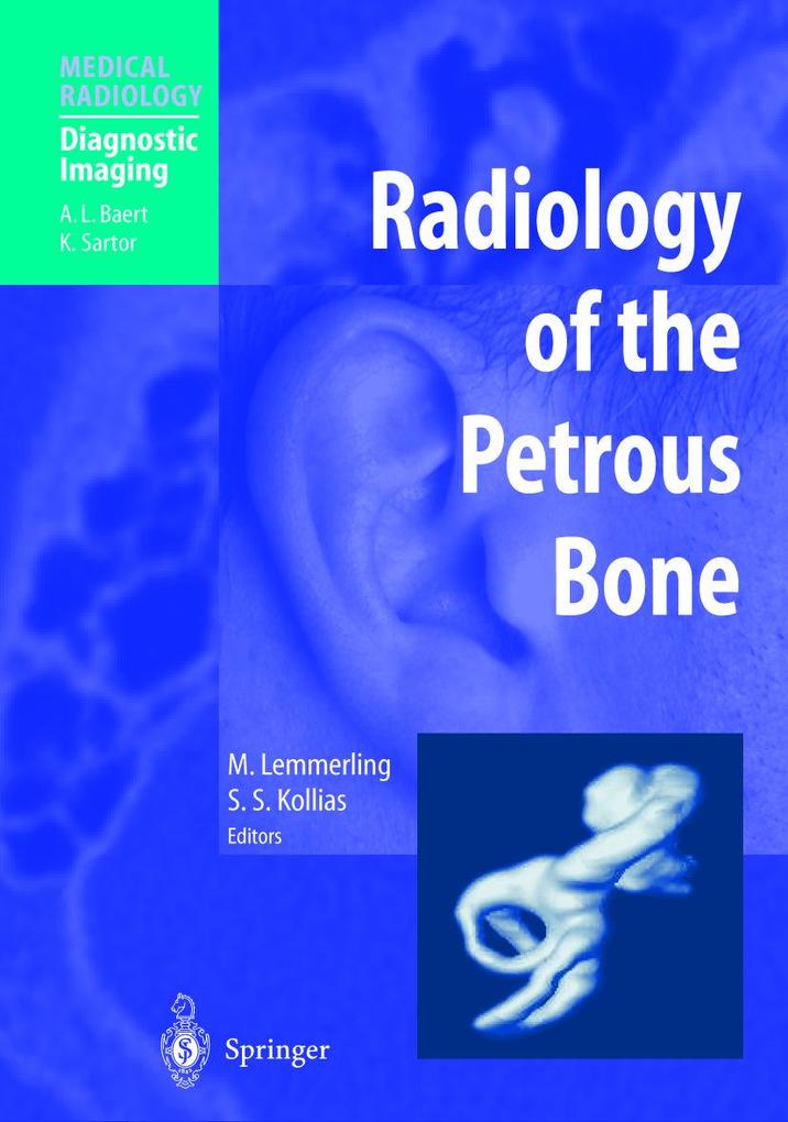 Produktbild: Radiology of the Petrous Bone