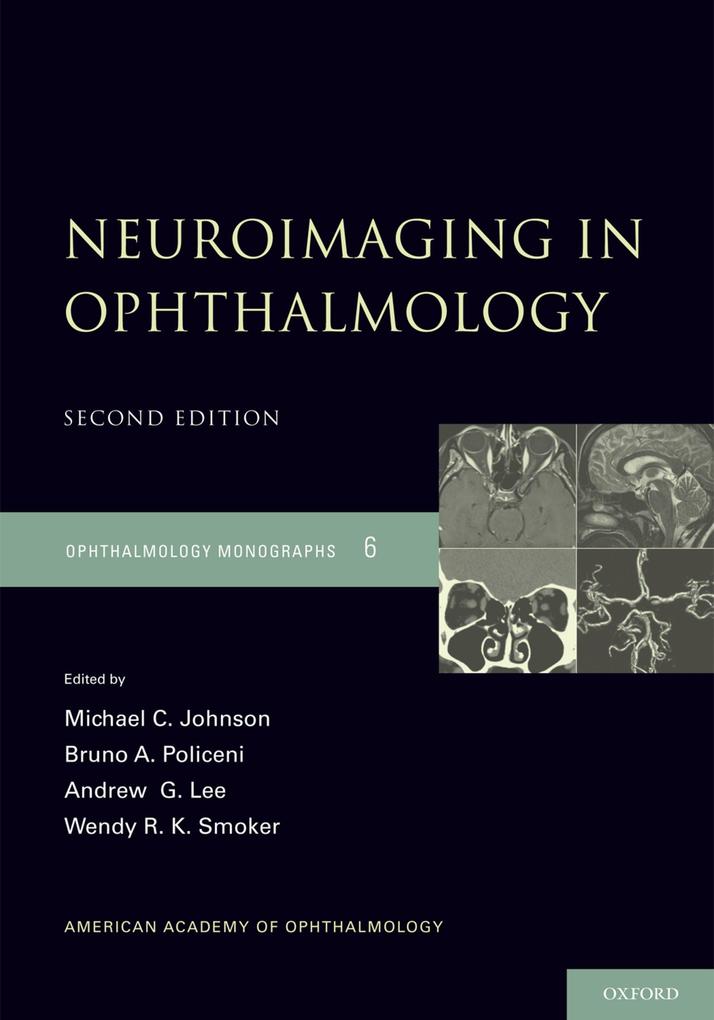 Neuroimaging in Ophthalmology.pdf