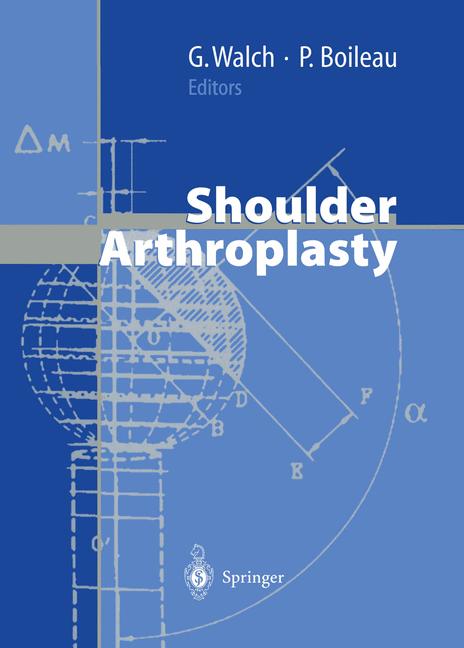 Weitere Ansicht: Shoulder Arthroplasty | N. Gschwend, R. J. Hawkins