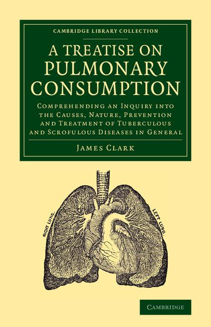A Treatise on Pulmonary Consumption.pdf