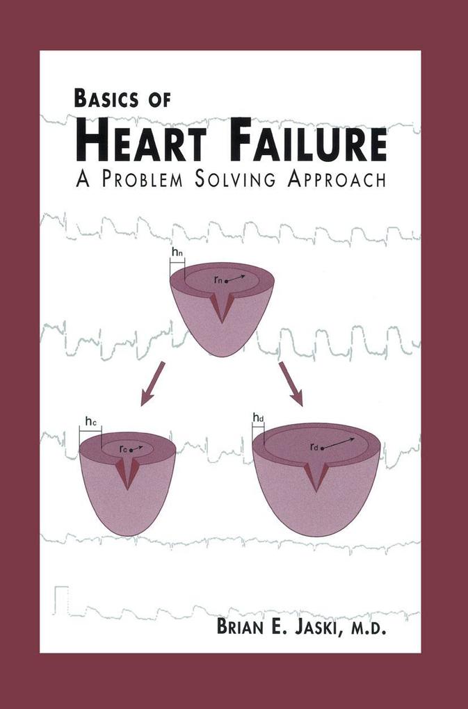 Basics of Heart Failure.pdf