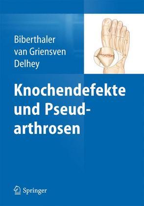 Weitere Ansicht: Knochendefekte und Pseudarthrosen