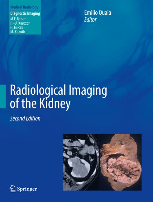 Weitere Ansicht: Radiological Imaging of the Kidney
