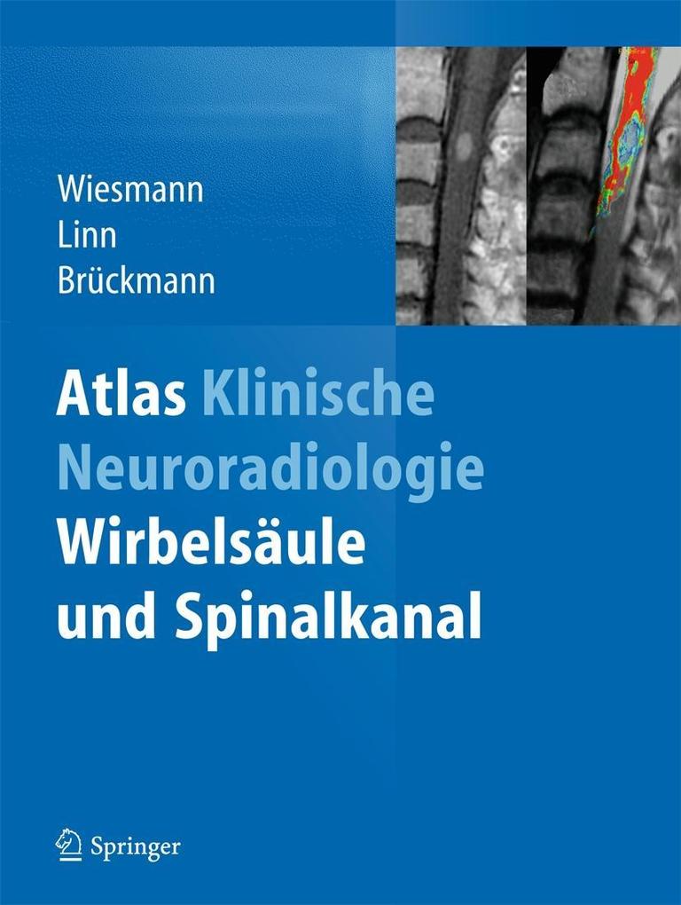 Produktbild: Atlas Klinische Neuroradiologie
