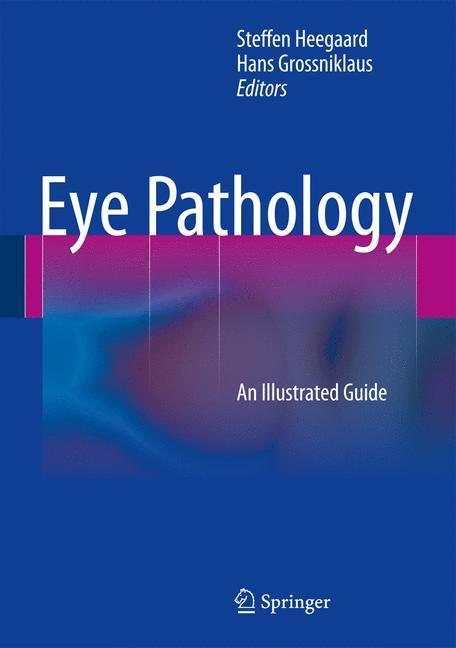 Weitere Ansicht: Eye Pathology