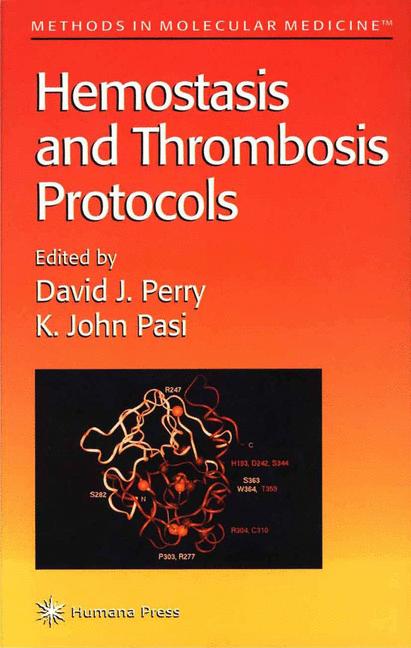 Weitere Ansicht: Hemostasis and Thrombosis Protocols