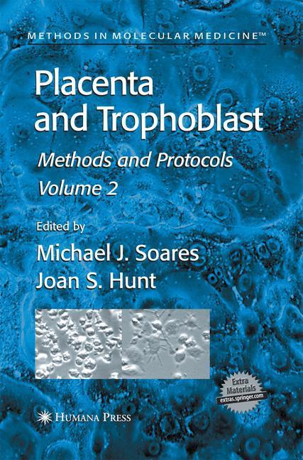 Weitere Ansicht: Placenta and Trophoblast