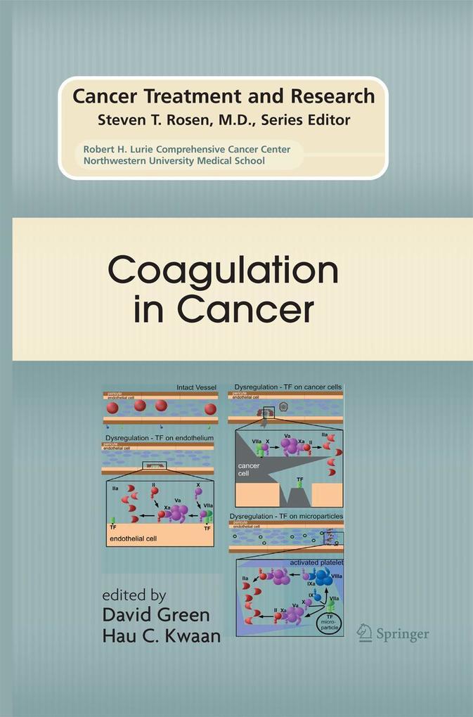 Produktbild: Coagulation in Cancer