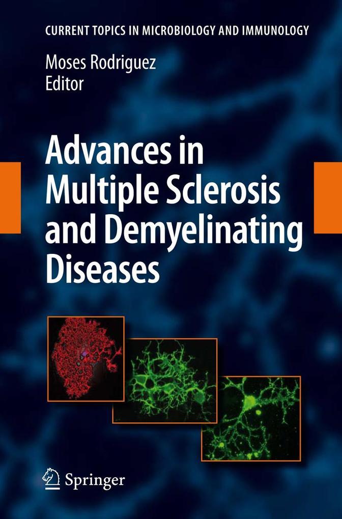 Produktbild: Advances in Multiple Sclerosis and Experimental Demyelinating Diseases