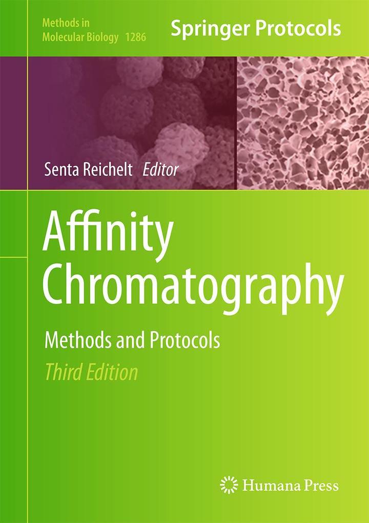 Produktbild: Affinity Chromatography