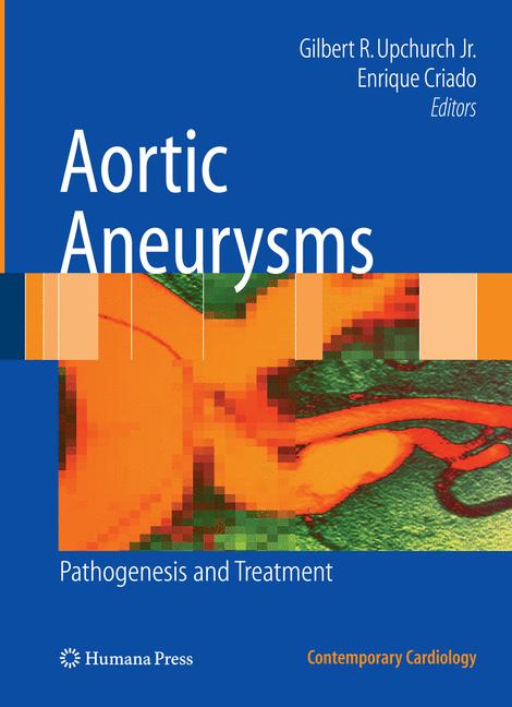 Weitere Ansicht: Aortic Aneurysms