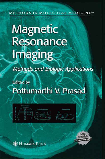 Weitere Ansicht: Magnetic Resonance Imaging
