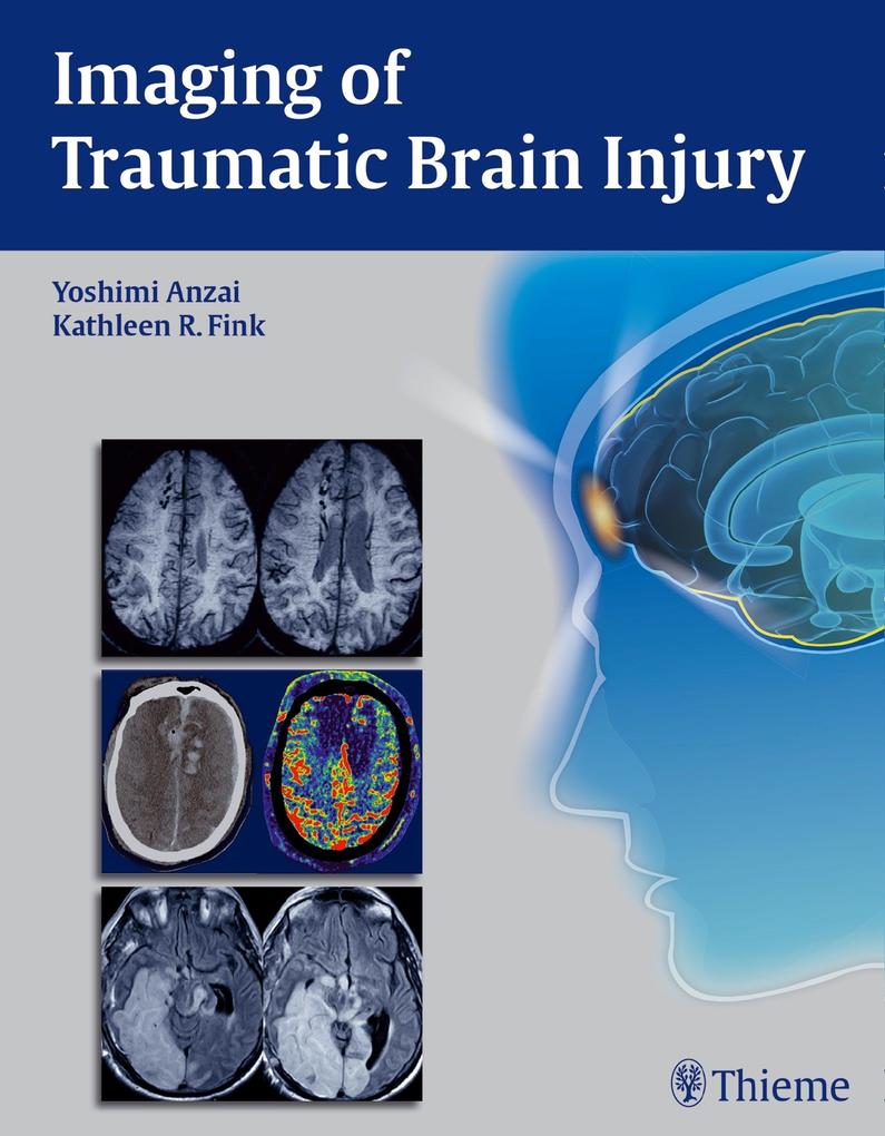 Produktbild: Imaging of Traumatic Brain Injury