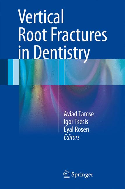 Weitere Ansicht: Vertical Root Fractures in Dentistry