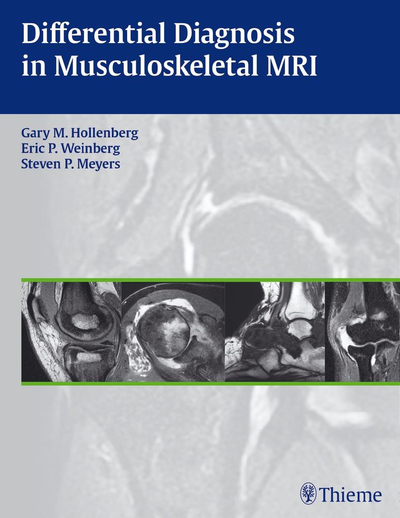 Produktbild: Differential Diagnosis in Musculoskeletal MRI