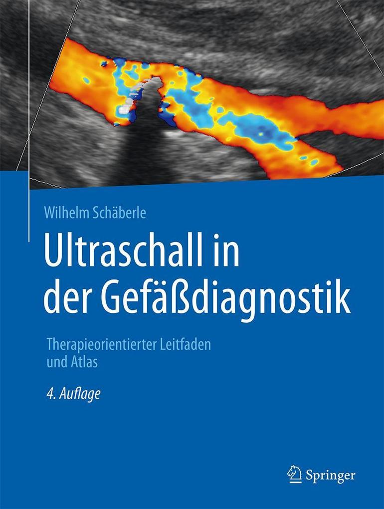 Produktbild: Ultraschall in der Gefäßdiagnostik | Wilhelm Schäberle