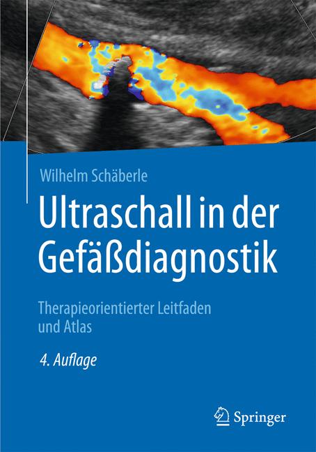 Weitere Ansicht: Ultraschall in der Gefäßdiagnostik | Wilhelm Schäberle