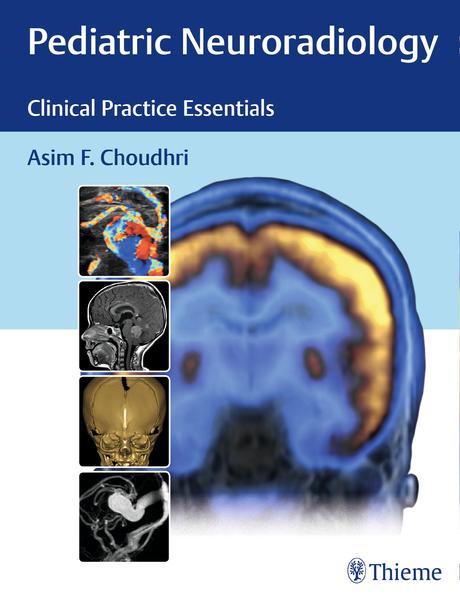 Produktbild: Pediatric Neuroradiology | Asim F Choudhri