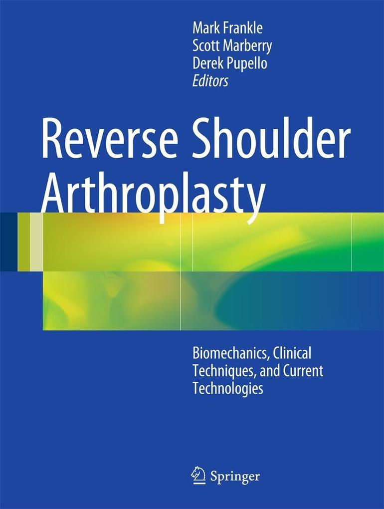Produktbild: Reverse Shoulder Arthroplasty