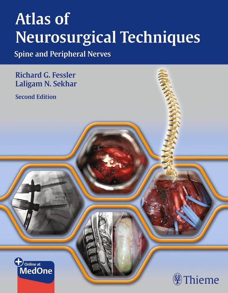 Produktbild: Atlas of Neurosurgical Techniques