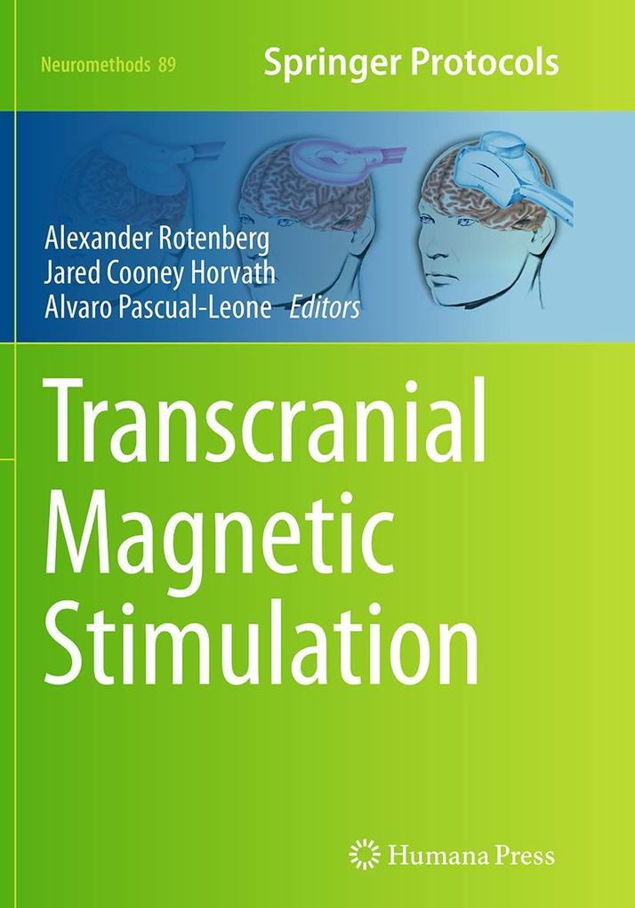 Produktbild: Transcranial Magnetic Stimulation