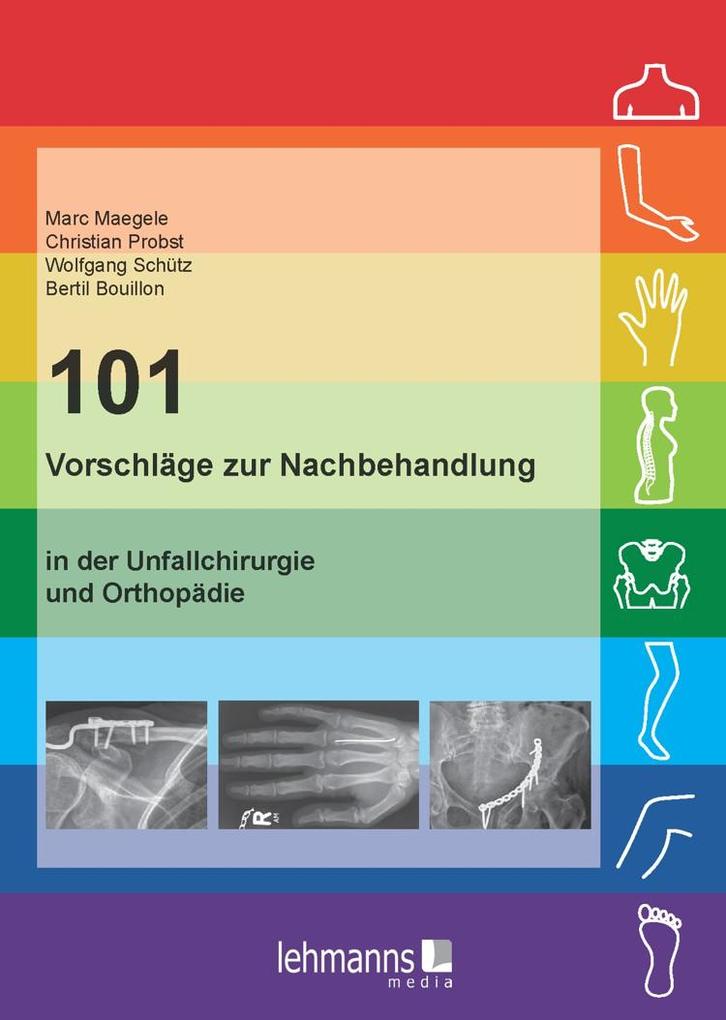 Produktbild: 101 Vorschläge zur Nachbehandlung | Marc Maegele, Christian Probst, Wolfgang Schütz, Bertil Bouillon