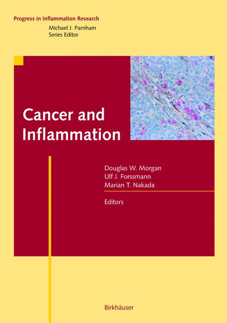Weitere Ansicht: Cancer and Inflammation