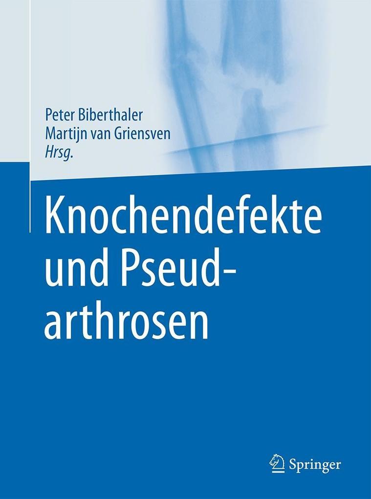 Produktbild: Knochendefekte und Pseudarthrosen