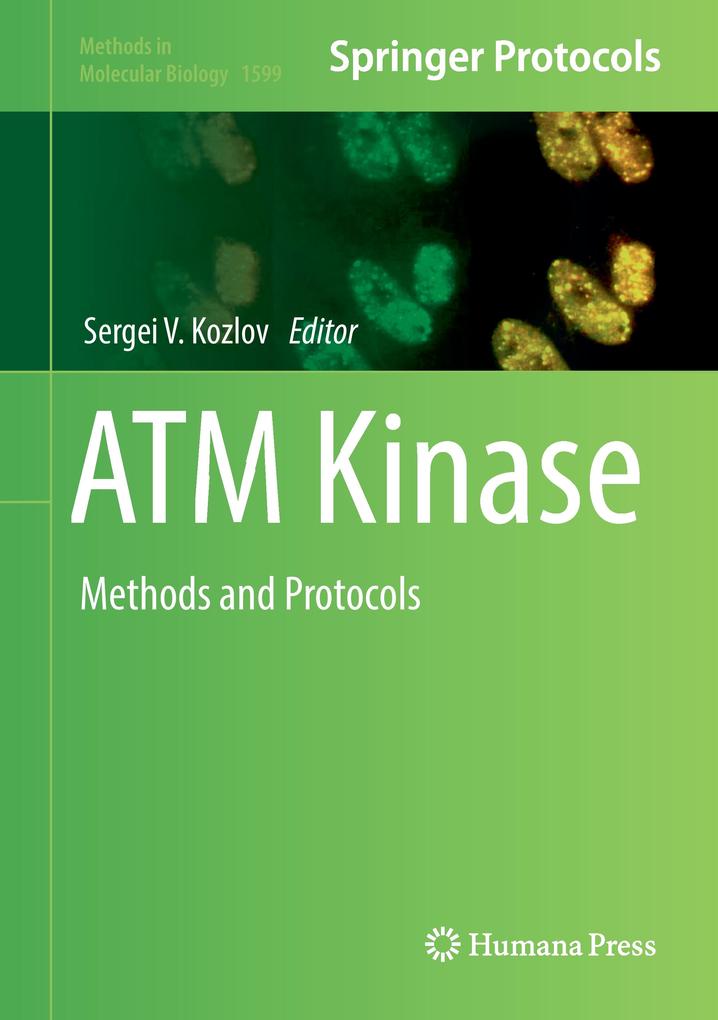 Produktbild: ATM Kinase